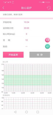 妇产医院母婴监护  v1.1图2